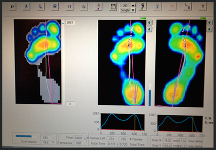 Statsaut. fodterapeut tilbyder 3D-scanninger af dine fødder på klinikken i Næstved